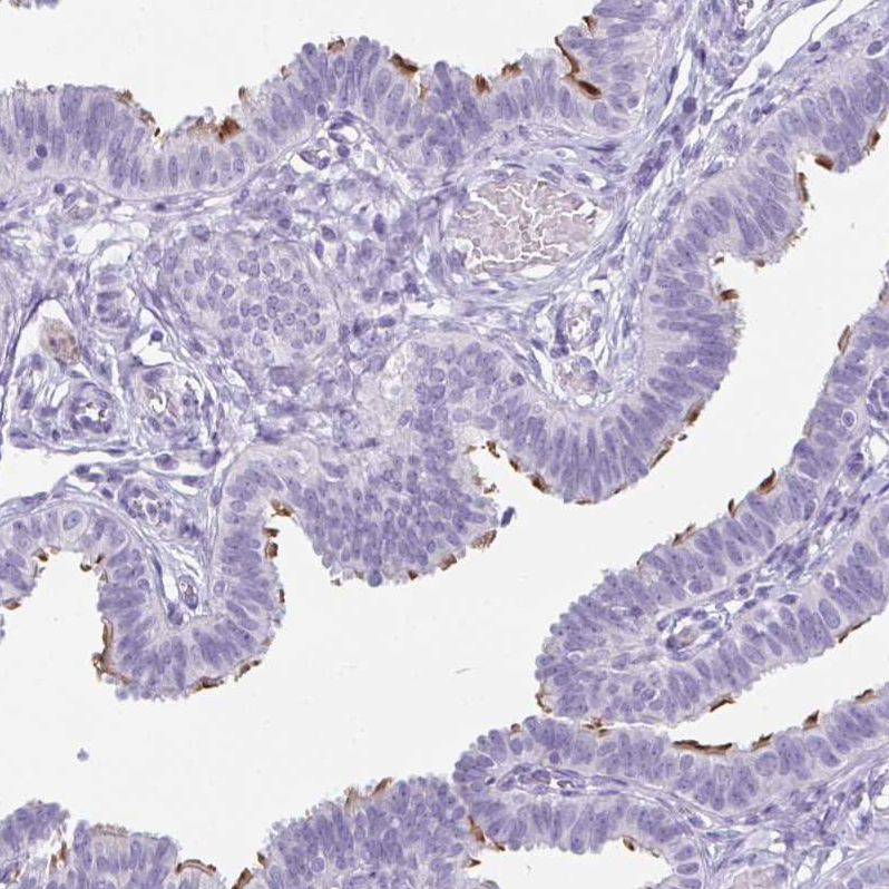 enkurin Antibody - BSA Free Immunohistochemistry-Paraffin: enkurin Antibody - BSA Free [NBP1-89911]