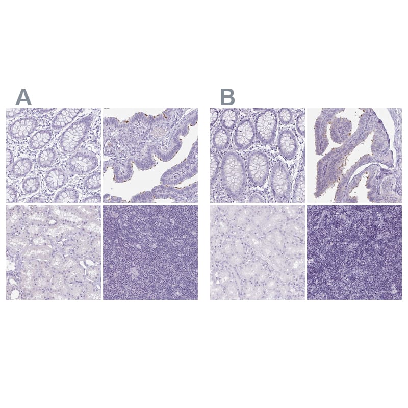 enkurin Antibody - BSA Free Immunohistochemistry-Paraffin: enkurin Antibody - BSA Free [NBP1-89911]