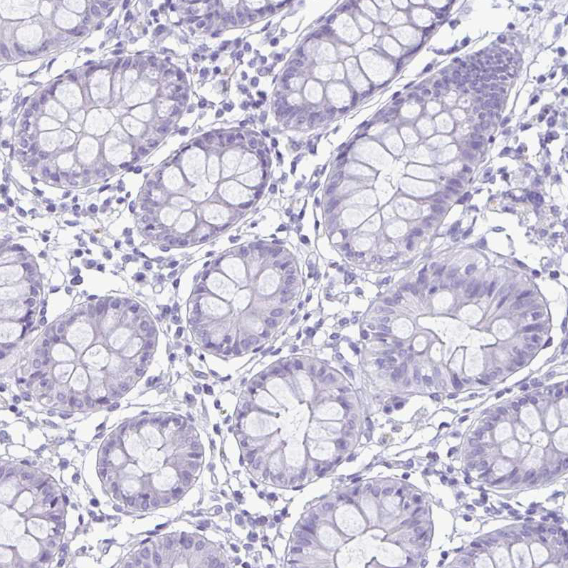 enkurin Antibody - BSA Free Immunohistochemistry-Paraffin: enkurin Antibody - BSA Free [NBP1-89911]