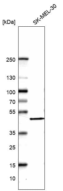 BXDC5 Antibody - BSA Free Western Blot: BXDC5 Antibody - BSA Free [NBP1-89915]