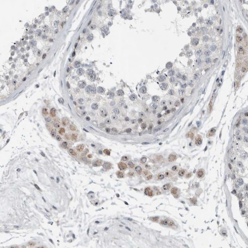 BXDC5 Antibody - BSA Free Immunohistochemistry-Paraffin: BXDC5 Antibody - BSA Free [NBP1-89915]