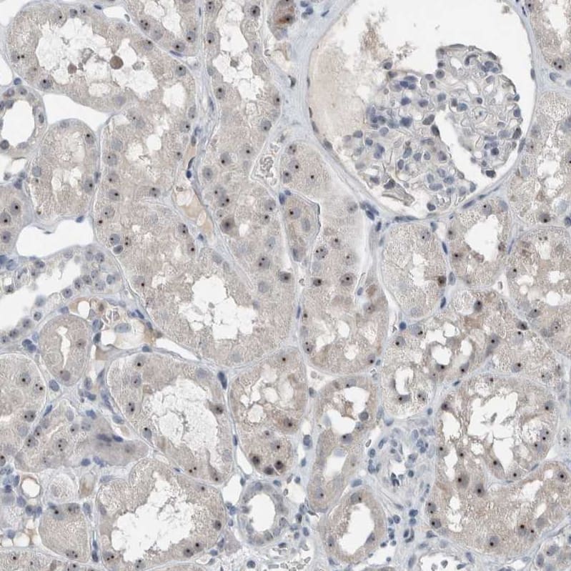 BXDC5 Antibody - BSA Free Immunohistochemistry-Paraffin: BXDC5 Antibody - BSA Free [NBP1-89915]