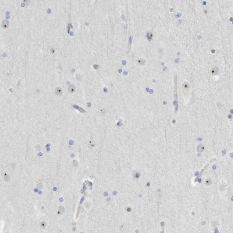 BXDC5 Antibody - BSA Free Immunohistochemistry-Paraffin: BXDC5 Antibody - BSA Free [NBP1-89915]