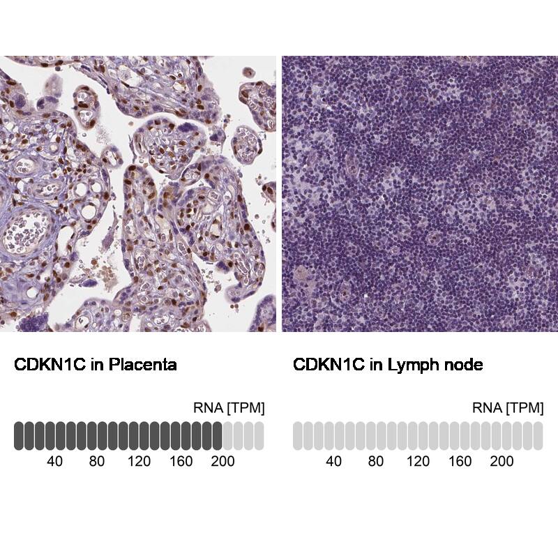 p57 Kip2 Antibody - BSA Free Immunohistochemistry-Paraffin: p57 Kip2 Antibody - BSA Free [NBP1-89917]