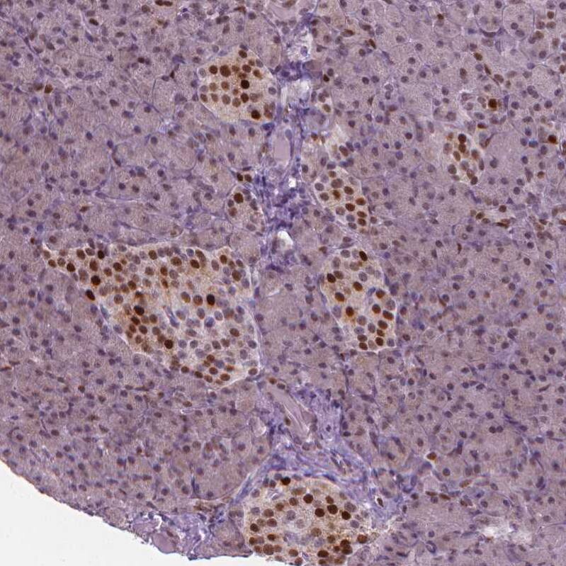 p57 Kip2 Antibody - BSA Free Immunohistochemistry-Paraffin: p57 Kip2 Antibody - BSA Free [NBP1-89917]