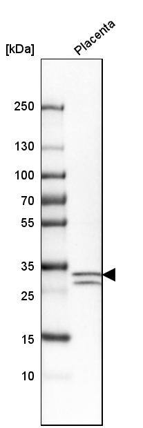 p57 Kip2 Antibody - BSA Free Western Blot: p57 Kip2 Antibody - BSA Free [NBP1-89917]