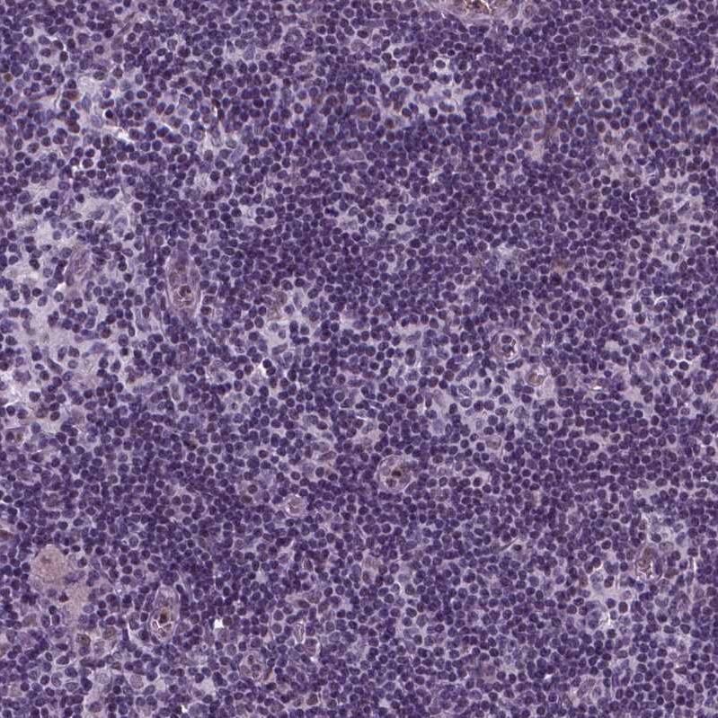 p57 Kip2 Antibody - BSA Free Immunohistochemistry-Paraffin: p57 Kip2 Antibody - BSA Free [NBP1-89917]