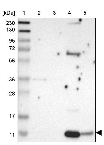 CXCL7/NAP-2 Antibody - BSA Free Western Blot: CXCL7/NAP-2 Antibody - BSA Free [NBP1-89921]