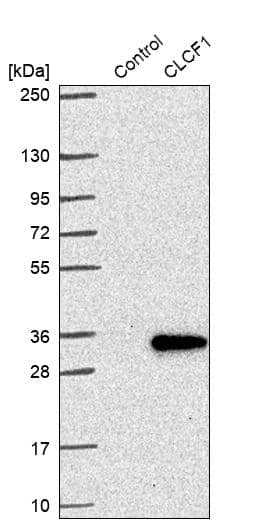 CLC Antibody - BSA Free Western Blot: CLC Antibody - BSA Free [NBP1-89926]