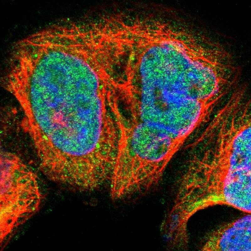 Blooms Syndrome Protein Blm Antibody - BSA Free Immunocytochemistry/ Immunofluorescence: Blooms Syndrome Protein Blm Antibody [NBP1-89929]