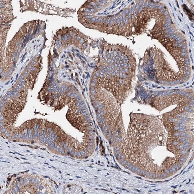 WDR11 Antibody - BSA Free Immunohistochemistry-Paraffin: WDR11 Antibody [NBP1-89930]