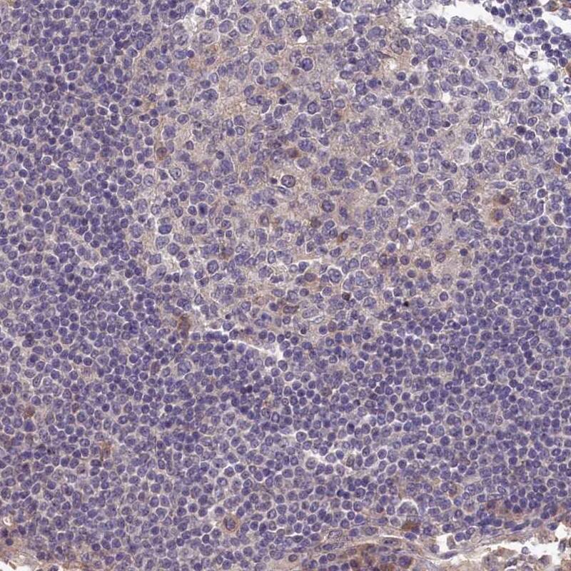 BRUNOL5 Antibody - BSA Free Immunohistochemistry-Paraffin: BRUNOL5 Antibody - BSA Free [NBP1-89931]