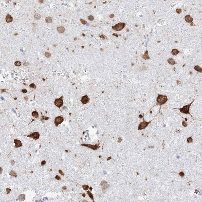 BRUNOL4 Antibody - BSA Free Immunohistochemistry-Paraffin: BRUNOL4 Antibody - BSA Free [NBP1-89932]