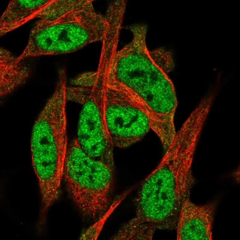 TNRC4 Antibody - BSA Free Immunocytochemistry/ Immunofluorescence: TNRC4 Antibody - BSA Free [NBP1-89933]