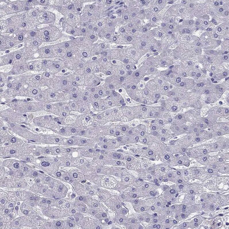 DRIL1 Antibody - BSA Free Immunohistochemistry-Paraffin: DRIL1 Antibody - BSA Free [NBP1-89938]
