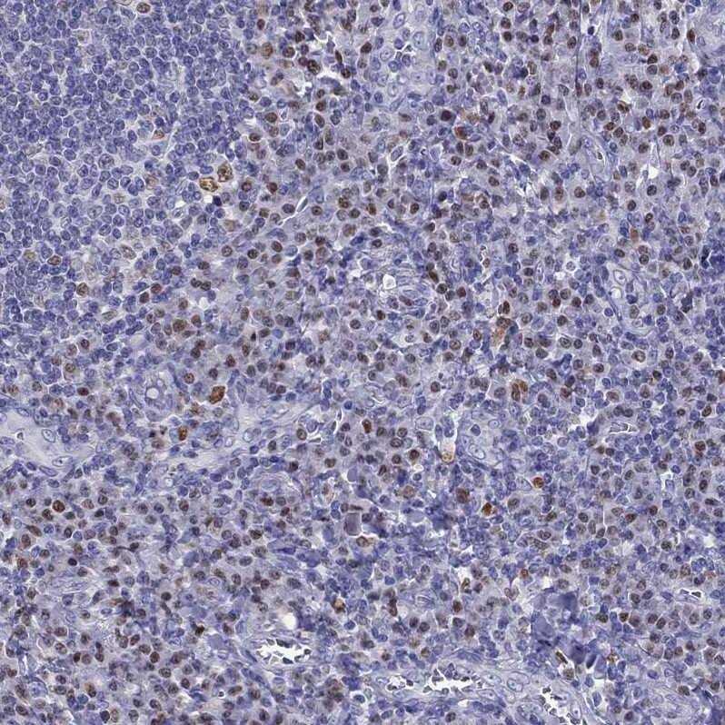 DRIL1 Antibody - BSA Free Immunohistochemistry-Paraffin: DRIL1 Antibody - BSA Free [NBP1-89938]