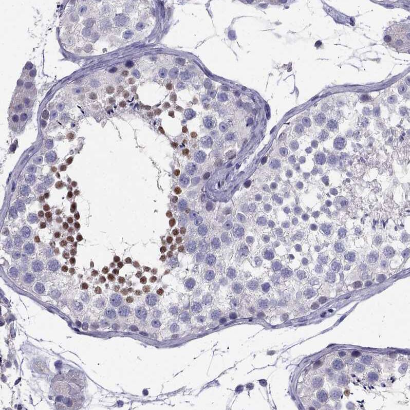 DRIL1 Antibody - BSA Free Immunohistochemistry-Paraffin: DRIL1 Antibody - BSA Free [NBP1-89938]
