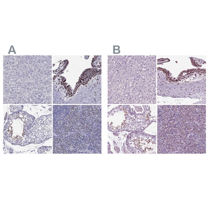 DRIL1 Antibody - BSA Free Immunohistochemistry-Paraffin: DRIL1 Antibody - BSA Free [NBP1-89938]