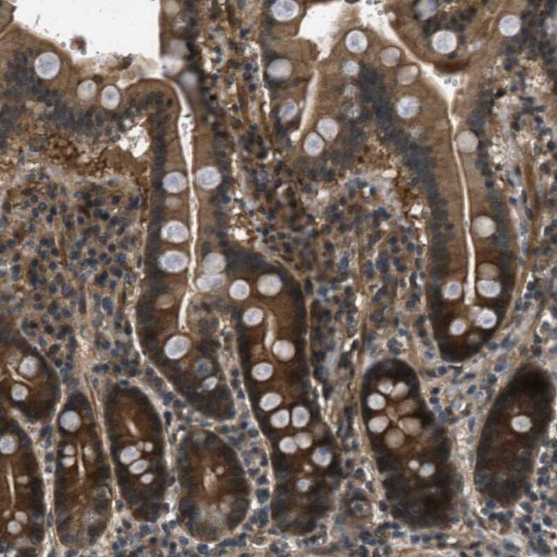 Epithelial Stromal Interaction 1 Antibody - BSA Free Immunohistochemistry-Paraffin: Epithelial Stromal Interaction 1 Antibody - BSA Free [NBP1-89940]