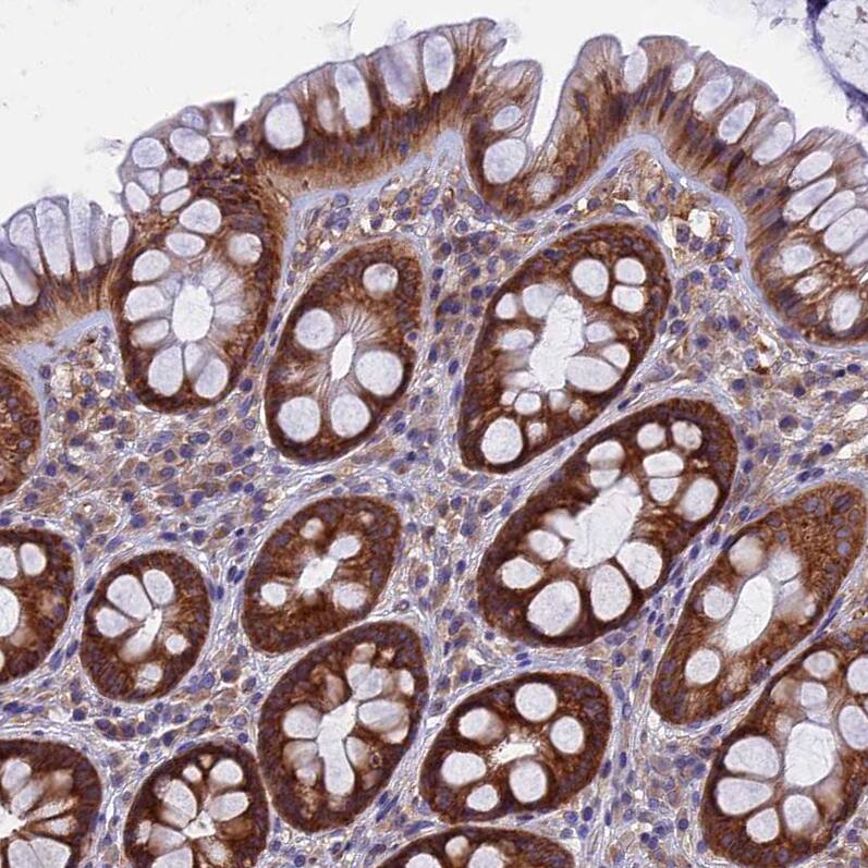 YB1 Antibody - BSA Free Immunohistochemistry-Paraffin: YB1 Antibody - BSA Free [NBP1-89945]