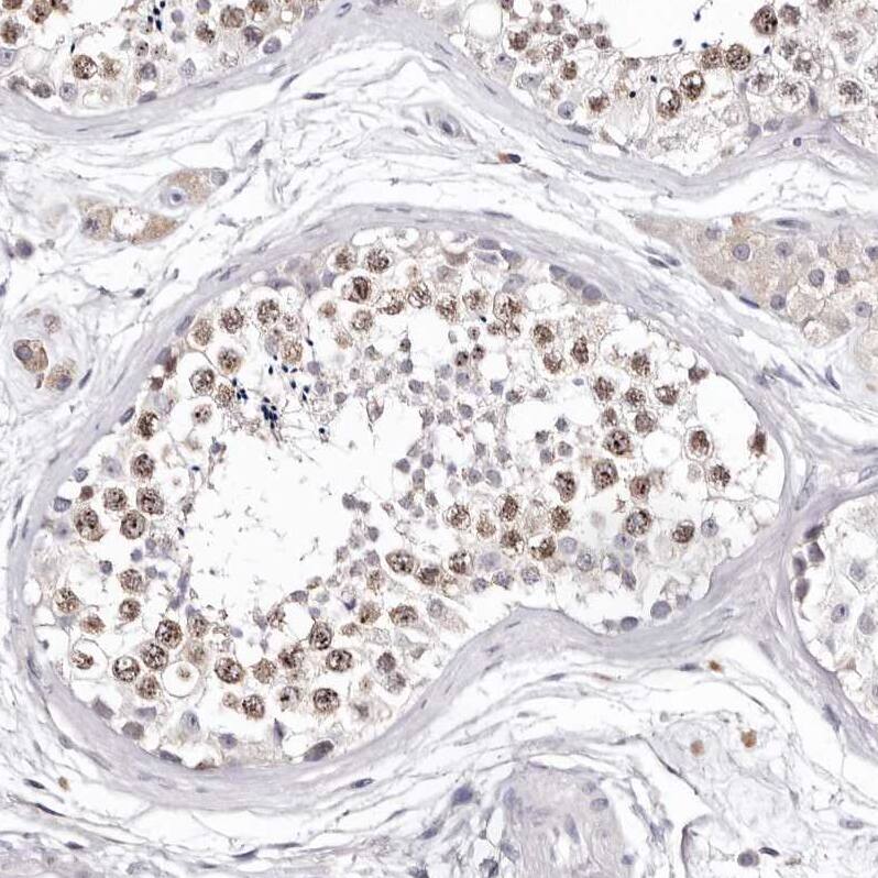 Borealin Antibody - BSA Free Immunohistochemistry-Paraffin: Borealin Antibody - BSA Free [NBP1-89949]