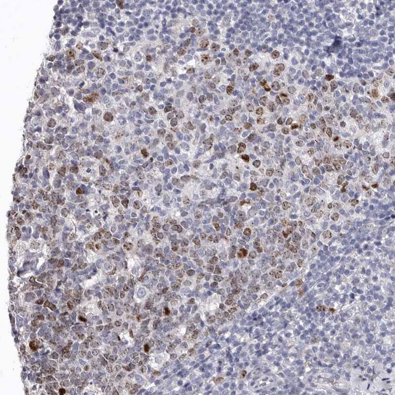 Borealin Antibody - BSA Free Immunohistochemistry-Paraffin: Borealin Antibody - BSA Free [NBP1-89949]