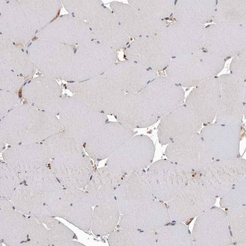 Borealin Antibody - BSA Free Immunohistochemistry-Paraffin: Borealin Antibody - BSA Free [NBP1-89951]
