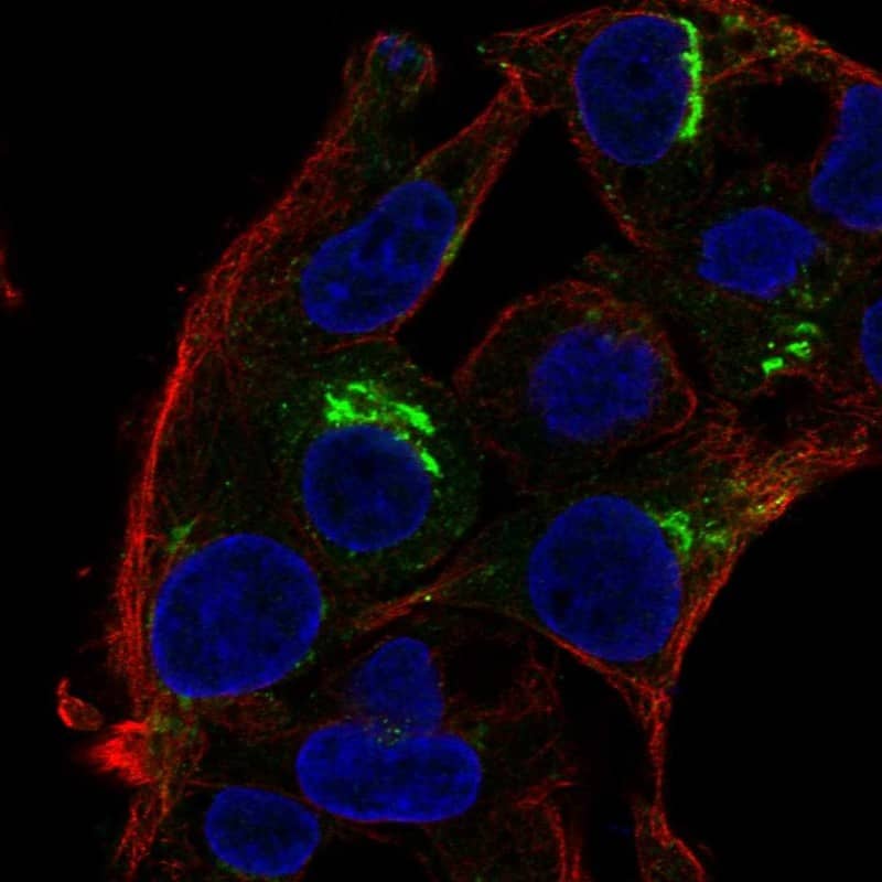 Osteopontin/OPN Antibody - BSA Free Immunocytochemistry/ Immunofluorescence: Osteopontin/OPN Antibody [NBP1-89952]