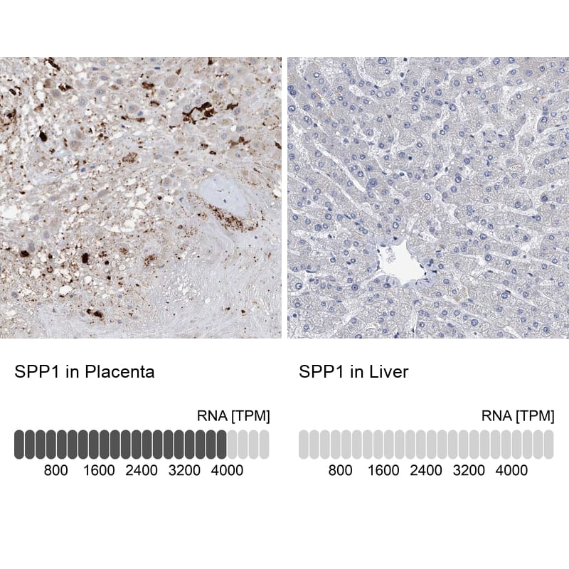 Osteopontin/OPN Antibody - BSA Free Immunohistochemistry-Paraffin: Osteopontin/OPN Antibody - BSA Free [NBP1-89952]