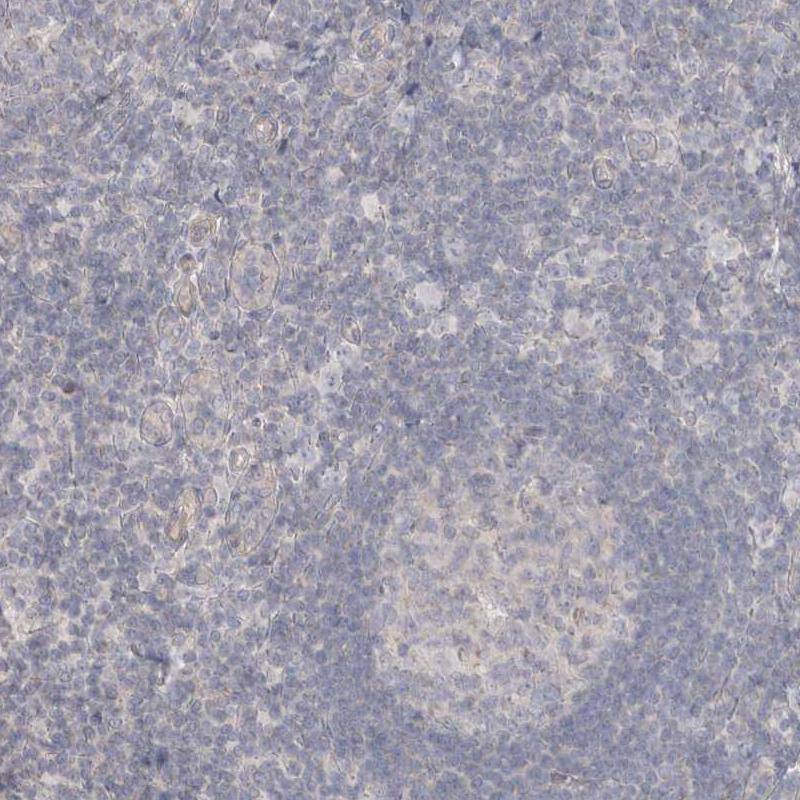 Dystrophin Antibody - BSA Free Immunohistochemistry-Paraffin: Dystrophin Antibody - BSA Free [NBP1-89953]
