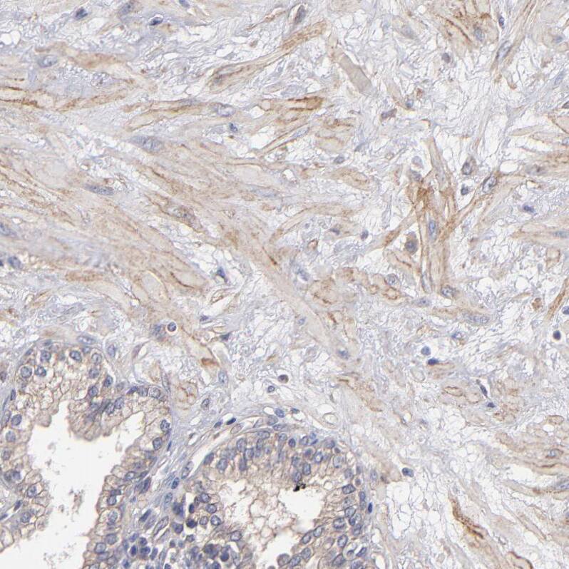 Dystrophin Antibody - BSA Free Immunohistochemistry-Paraffin: Dystrophin Antibody - BSA Free [NBP1-89954]