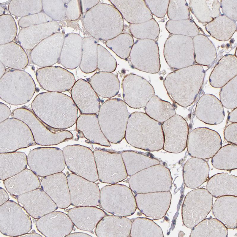 Dystrophin Antibody - BSA Free Immunohistochemistry-Paraffin: Dystrophin Antibody - BSA Free [NBP1-89954]
