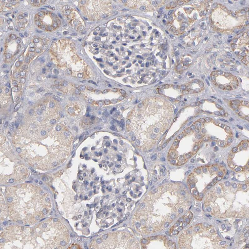 Dystrophin Antibody - BSA Free Immunohistochemistry-Paraffin: Dystrophin Antibody - BSA Free [NBP1-89954]