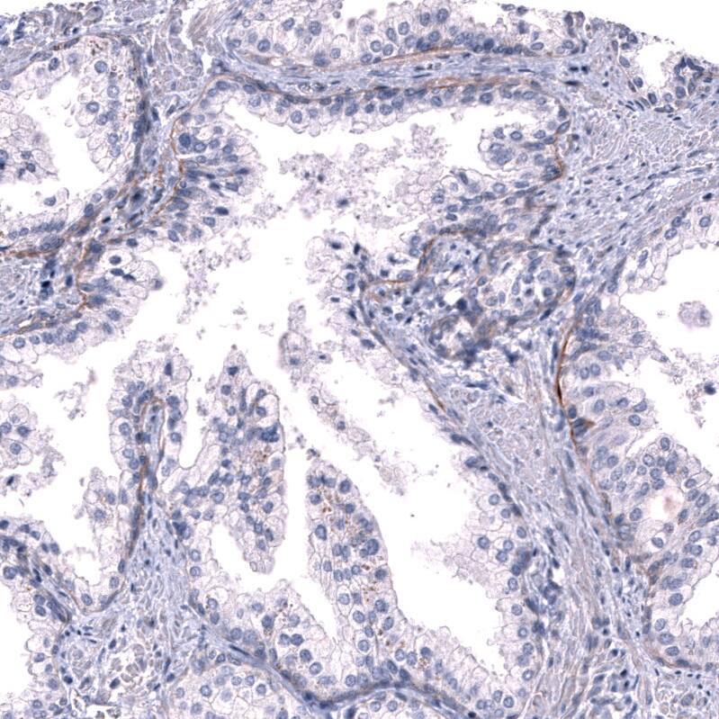 Laminin alpha 3 Antibody - BSA Free Immunohistochemistry-Paraffin: Laminin alpha 3 Antibody - BSA Free [NBP1-89955]