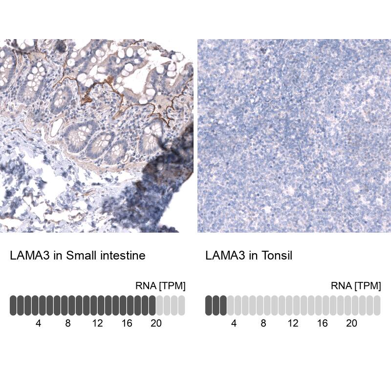 Laminin alpha 3 Antibody - BSA Free Immunohistochemistry-Paraffin: Laminin alpha 3 Antibody - BSA Free [NBP1-89955]