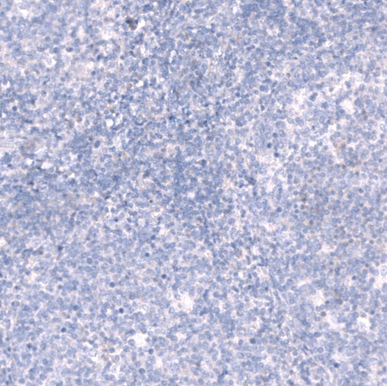 Laminin alpha 3 Antibody - BSA Free Immunohistochemistry-Paraffin: Laminin alpha 3 Antibody - BSA Free [NBP1-89955]