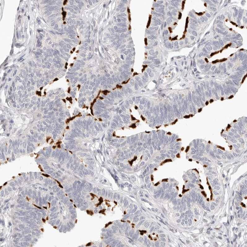 Leukotriene B4 Receptor 2 Antibody - BSA Free Immunohistochemistry-Paraffin: Leukotriene B4 Receptor 2 Antibody - BSA Free [NBP1-89960]