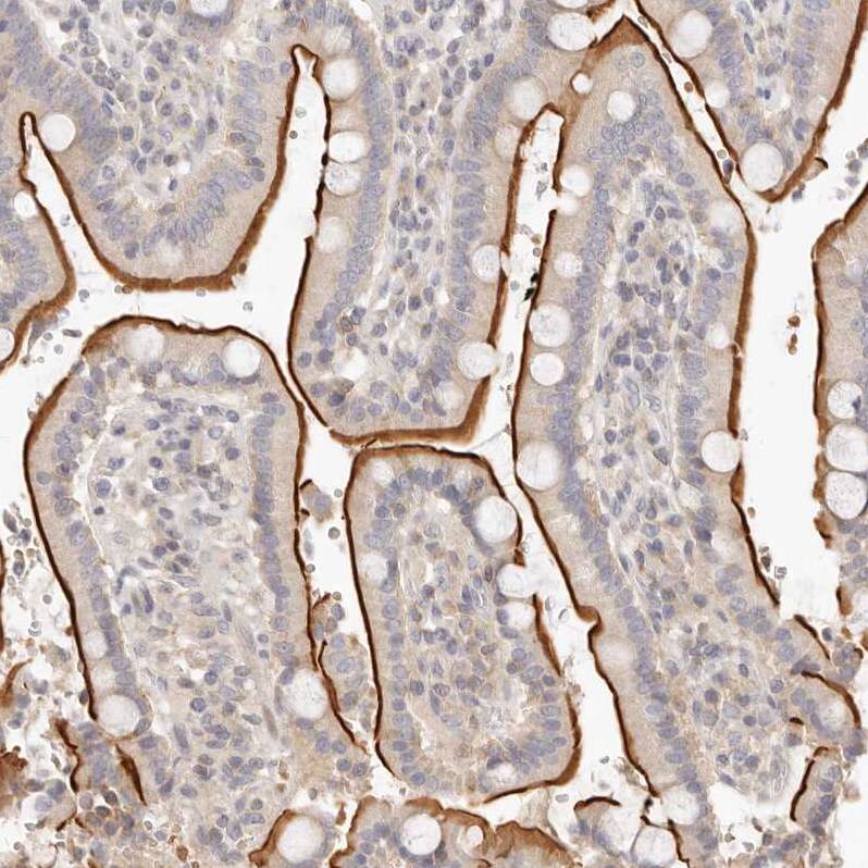 Leukotriene B4 Receptor 2 Antibody - BSA Free Immunohistochemistry-Paraffin: Leukotriene B4 Receptor 2 Antibody - BSA Free [NBP1-89960]