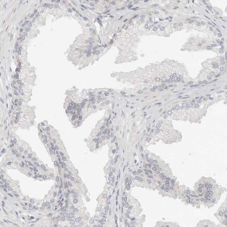Leukotriene B4 Receptor 2 Antibody - BSA Free Immunohistochemistry-Paraffin: Leukotriene B4 Receptor 2 Antibody - BSA Free [NBP1-89960]