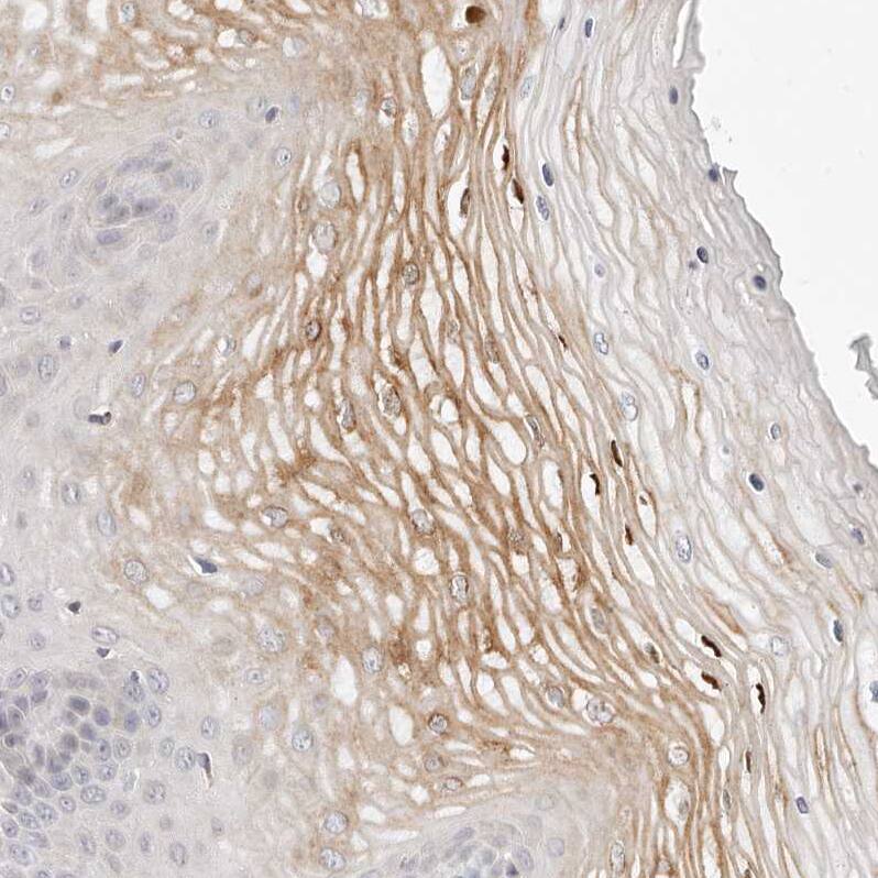 Leukotriene B4 Receptor 2 Antibody - BSA Free Immunohistochemistry-Paraffin: Leukotriene B4 Receptor 2 Antibody - BSA Free [NBP1-89960]