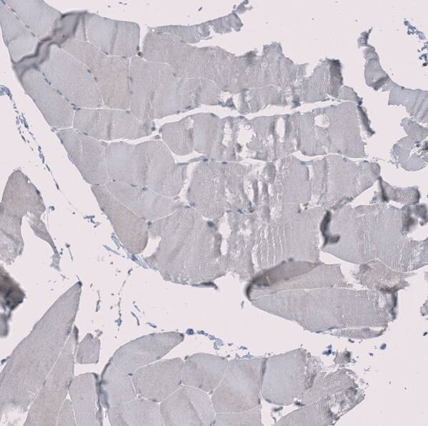 RMI2 Antibody - BSA Free Immunohistochemistry-Paraffin: RMI2 Antibody - BSA Free [NBP1-89962]