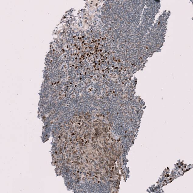 RMI2 Antibody - BSA Free Immunohistochemistry-Paraffin: RMI2 Antibody - BSA Free [NBP1-89962]