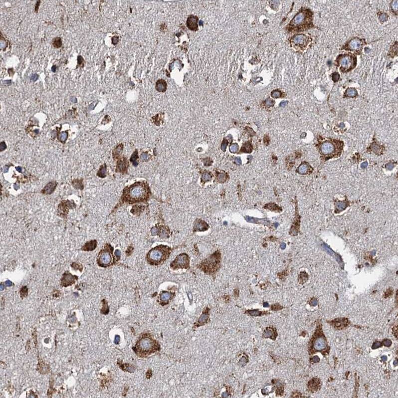 GRP78/HSPA5 Antibody - BSA Free Immunohistochemistry-Paraffin: GRP78/HSPA5 Antibody - BSA Free [NBP1-89968]