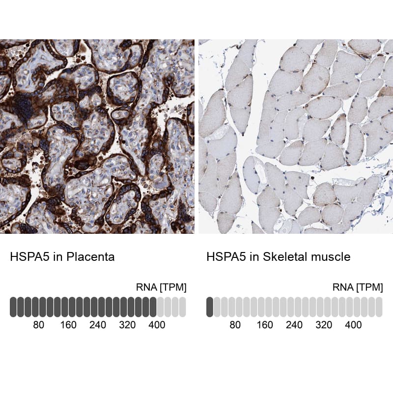 GRP78/HSPA5 Antibody - BSA Free Immunohistochemistry-Paraffin: GRP78/HSPA5 Antibody [NBP1-89969]