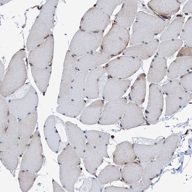 GRP78/HSPA5 Antibody - BSA Free Immunohistochemistry-Paraffin: GRP78/HSPA5 Antibody [NBP1-89969]