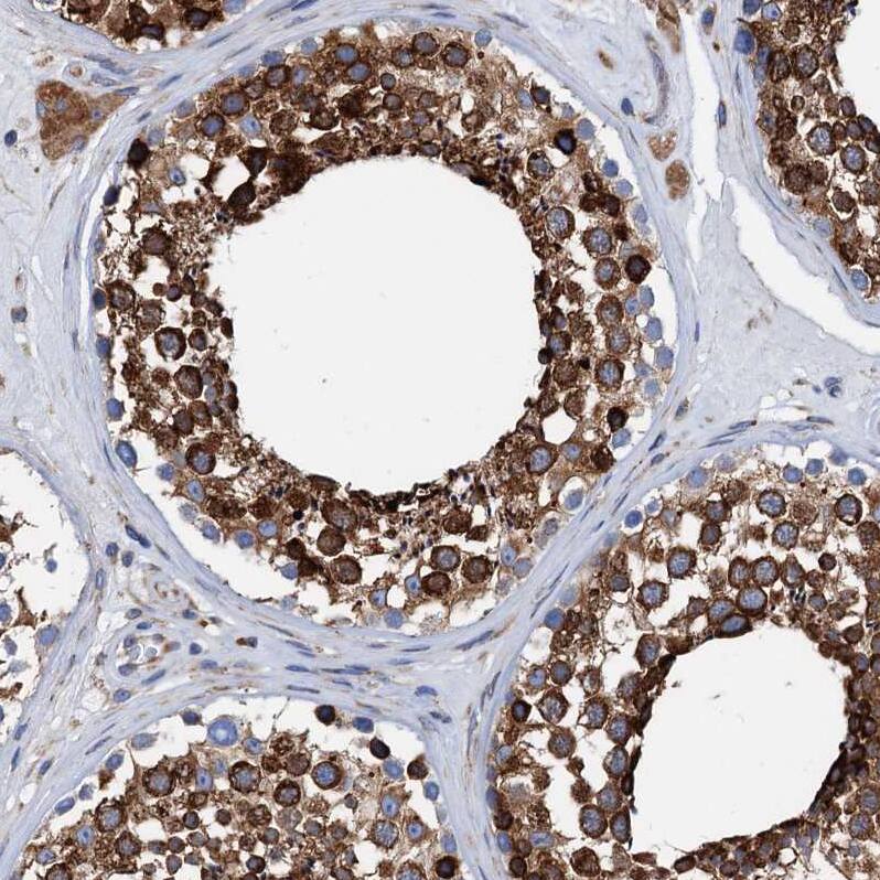 GRP78/HSPA5 Antibody - BSA Free Immunohistochemistry-Paraffin: GRP78/HSPA5 Antibody [NBP1-89969]