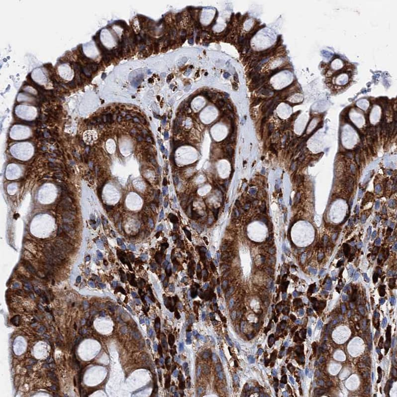 GRP78/HSPA5 Antibody - BSA Free Immunohistochemistry-Paraffin: GRP78/HSPA5 Antibody [NBP1-89969]
