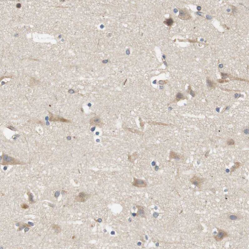 Endophilin B1/Bif-1 Antibody - BSA Free Immunohistochemistry-Paraffin: Endophilin B1/Bif-1 Antibody - BSA Free [NBP1-89972]