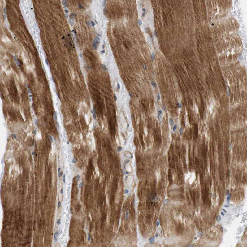Endophilin B1/Bif-1 Antibody - BSA Free Immunohistochemistry-Paraffin: Endophilin B1/Bif-1 Antibody - BSA Free [NBP1-89972]