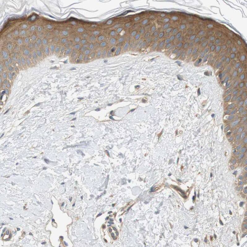 Endophilin B1/Bif-1 Antibody - BSA Free Immunohistochemistry-Paraffin: Endophilin B1/Bif-1 Antibody - BSA Free [NBP1-89972]